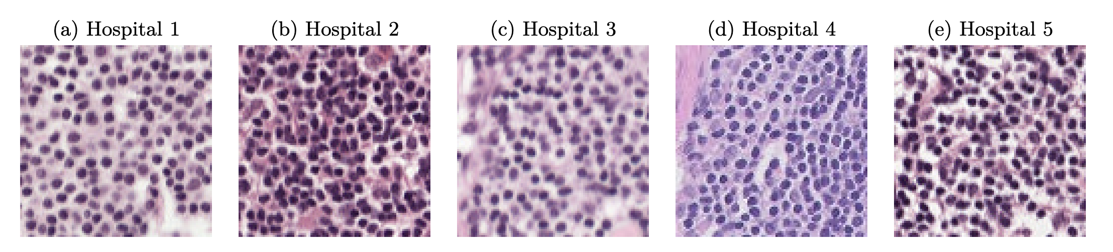 Hospital-to-hospital shift changes the robustness question. In medical imaging, distribution shift is often as important as explicit attack design. Image source: (Weng et al., 2023)